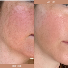 Load image into Gallery viewer, Skincare Bundle- ANTI-AGE RESTOCKED!