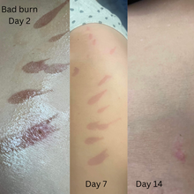 Load image into Gallery viewer, Calma Blossom Buds Miracle Balm 60g