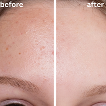 Load image into Gallery viewer, Calma Blossom Buds Blemish Balm 60g