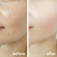 Load image into Gallery viewer, Calma Blossom Buds Antioxidant Face Oil 50ml