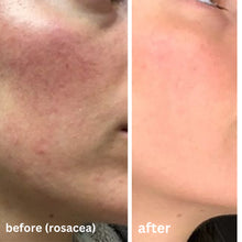 Load image into Gallery viewer, Calma Blossom Buds Elixir Serum- 30ml