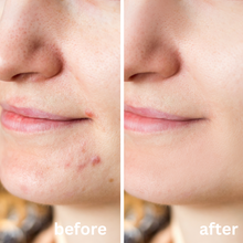 Load image into Gallery viewer, Calma Blossom Buds Blemish Balm 60g