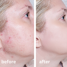 Load image into Gallery viewer, Calma Blossom Buds Blemish Balm 60g