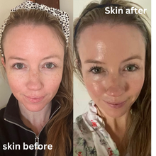 Load image into Gallery viewer, Calma Blossom Buds Miracle Balm 60g