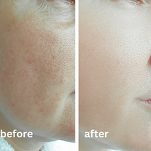 Load image into Gallery viewer, Skincare Bundle- ANTI-AGE RESTOCKED!
